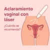 Ilustración digital de tratamiento de aclaramiento vaginal con láser en zona íntima femenina.